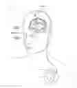 Fig. 01 - Non-regular electrical stimulation patterns for improved efficiency in treating Parkinson's disease