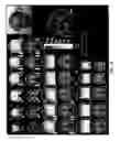 Fig. 33 - Central base coils for deep transcranial magnetic stimulation