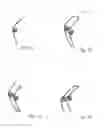 Fig. 06 - TORSION SPRING TRAMPOLINE