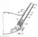 Fig. 10 - Golf club head
