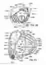 Fig. 45 - Golf club head