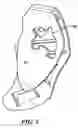 Fig. 06 - Low profile pocket tool