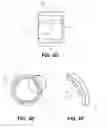 Fig. 07 - Injection molded cold-expansion compression collar