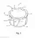Fig. 04 - Wheel centering sleeve