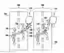 Fig. 01 - Method and device for controlling a vehicle