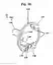 Fig. 07 - Systems and apparatus for controlling movement of objects through a fluid