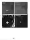 Fig. 02 - Compositions and methods for intravitreal delivery of polynucleotides to retinal cones