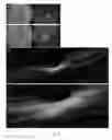 Fig. 03 - Compositions and methods for intravitreal delivery of polynucleotides to retinal cones