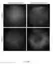 Fig. 06 - Compositions and methods for intravitreal delivery of polynucleotides to retinal cones