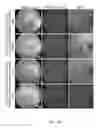Fig. 07 - Compositions and methods for intravitreal delivery of polynucleotides to retinal cones