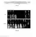 Fig. 12 - I domain chimeric antigen receptor specific to ICAM-1