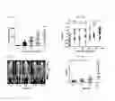 Fig. 05 - Transduced T cells expressing human SSTR2 and application thereof