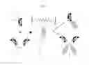 Fig. 08 - Increasing the half-life of a full-length or a functional fragment of variant anti-human TNF-alpha antibody