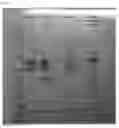 Fig. 07 - ACETYLATED PCSK9
