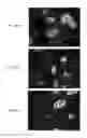 Fig. 25 - Methods using antibodies specific for 4,6-diamino-5-(formamido)pyrimidine