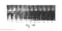 Fig. 06 - Colorimetric hydrogel based nanosensor for detection of therapeutic levels of ionizing radiation