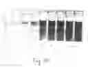 Fig. 08 - Colorimetric hydrogel based nanosensor for detection of therapeutic levels of ionizing radiation