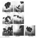 Fig. 32 - Colorimetric hydrogel based nanosensor for detection of therapeutic levels of ionizing radiation