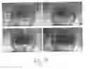Fig. 41 - Colorimetric hydrogel based nanosensor for detection of therapeutic levels of ionizing radiation