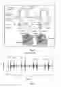 Fig. 04 - Method and device for preparing non-embryonic stem cells