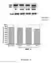 Fig. 07 - RNA interference mediated therapy for neurodegenerative diseases
