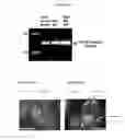 Fig. 09 - Replication factor C-40 (RFC40/RFC2) as a prognostic marker and target in estrogen positive and negative and triple negative breast cancer