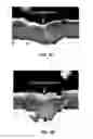 Fig. 03 - Processes for providing laminated coatings on workpieces, and articles made therefrom