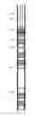 Fig. 01 - Drillable Oilfield Tubular Plug