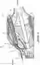Fig. 06 - Gas turbine engine exhaust system