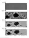Fig. 52 - Method for treating a cancer patient based on atomic therapeutic indexes and non-radiation therapy