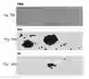 Fig. 53 - Method for treating a cancer patient based on atomic therapeutic indexes and non-radiation therapy