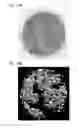 Fig. 66 - Method for treating a cancer patient based on atomic therapeutic indexes and non-radiation therapy