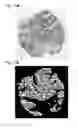 Fig. 67 - Method for treating a cancer patient based on atomic therapeutic indexes and non-radiation therapy