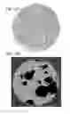 Fig. 69 - Method for treating a cancer patient based on atomic therapeutic indexes and non-radiation therapy