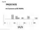 Fig. 75 - Method for treating a cancer patient based on atomic therapeutic indexes and non-radiation therapy