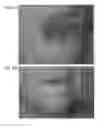 Fig. 82 - Method for treating a cancer patient based on atomic therapeutic indexes and non-radiation therapy