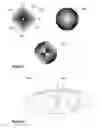 Fig. 07 - Plenoptic imaging device equipped with an enhanced optical system