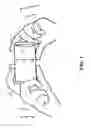 Fig. 02 - OPTICAL IMAGE STABILIZATION FOR FOLDED OPTICS CAMERA MODULES