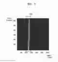 Fig. 08 - Time-of-flight measuring apparatus and image processing method for reducing blur of depth image therein