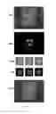 Fig. 64 - Systems, devices, and methods for tracking and compensating for patient motion during a medical imaging scan