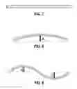 Fig. 06 - Location-specific tuning of stress to control bow to control overlay in semiconductor processing