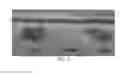 Fig. 03 - OXYFLUORFEN RESISTANT RICE LINES