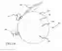 Fig. 16 - Surgical robotic access system for irregularly shaped robotic actuators and associated robotic surgical instruments