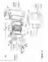 Fig. 02 - RF coil assembly with a head opening and isolation channel