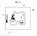 Fig. 09 - Cartilage quantification device, cartilage quantification method, and cartilage quantification program