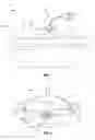 Fig. 02 - Systems and methods for enhancing uptake of therapeutic agent from bloodstream into disease site