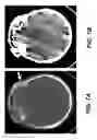Fig. 16 - APPARATUS AND METHOD FOR 4D X-RAY IMAGING