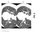 Fig. 17 - APPARATUS AND METHOD FOR 4D X-RAY IMAGING