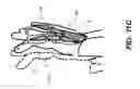 Fig. 23 - APPARATUS AND METHOD FOR 4D X-RAY IMAGING
