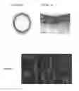 Fig. 02 - Apparatus, method and computer-accessible medium for obtaining tissue sample